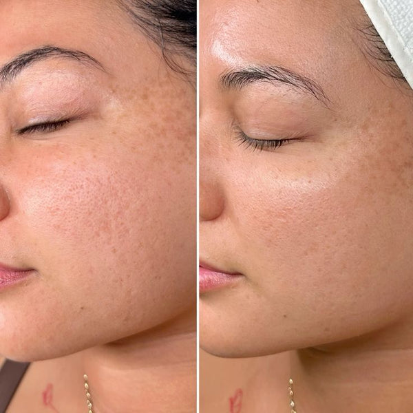Une peau transformée, masque après masque.