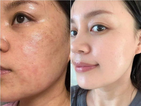 Une peau transformée, masque après masque.