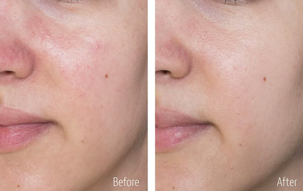 Résultat en quelques semaines !