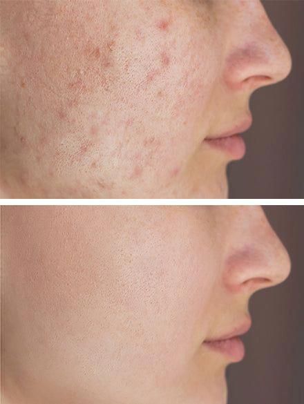 Résultat en quelques semaines !