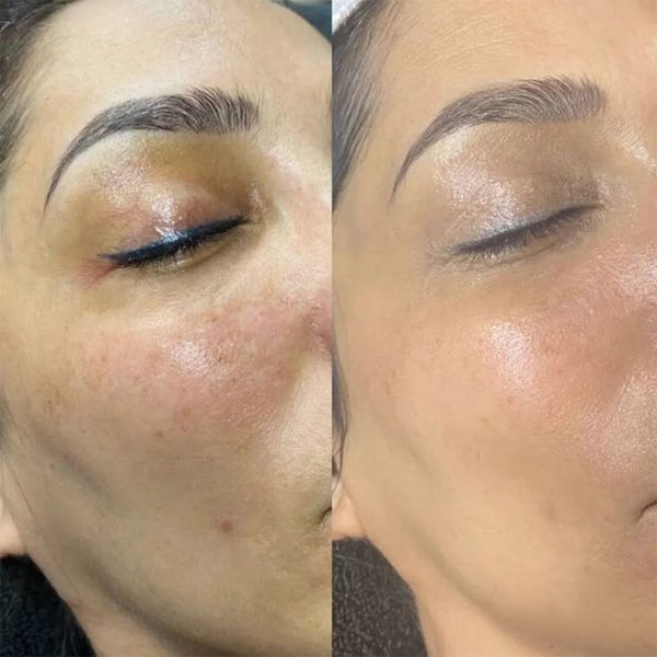 Résultat en quelques semaines !