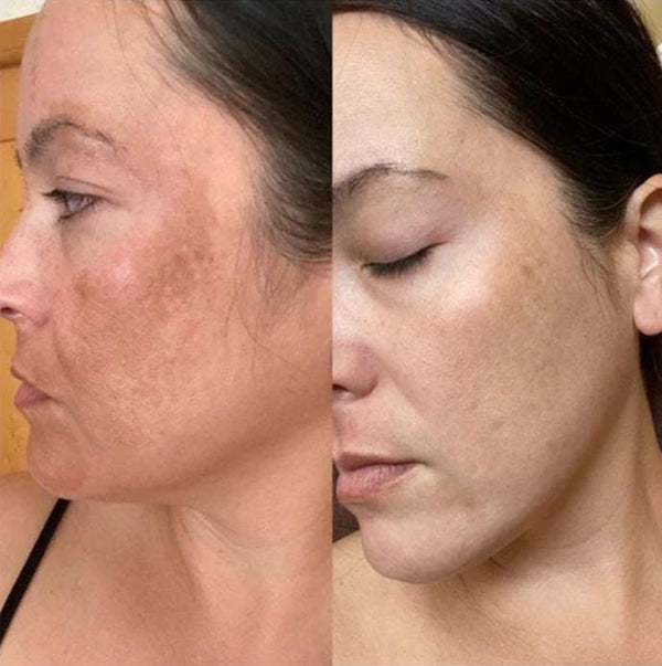Une peau transformée, masque après masque.