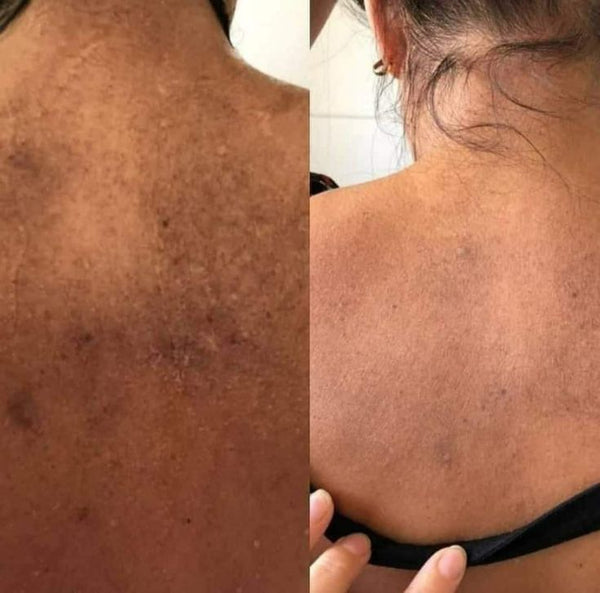 Une peau révélée